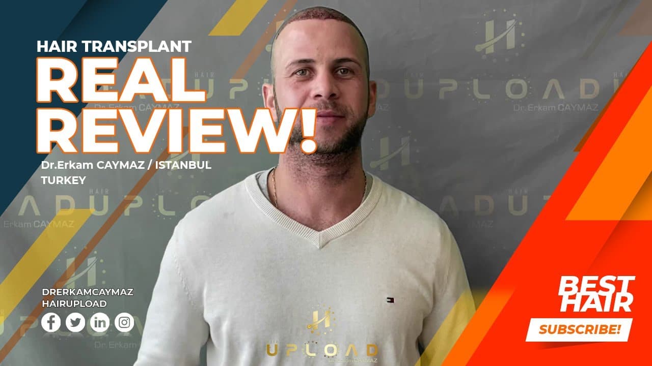 Mr.Daniel from USA 5500 Graft Sapphire Fue - Hair Uploading - Dr.Erkam CAYMAZ