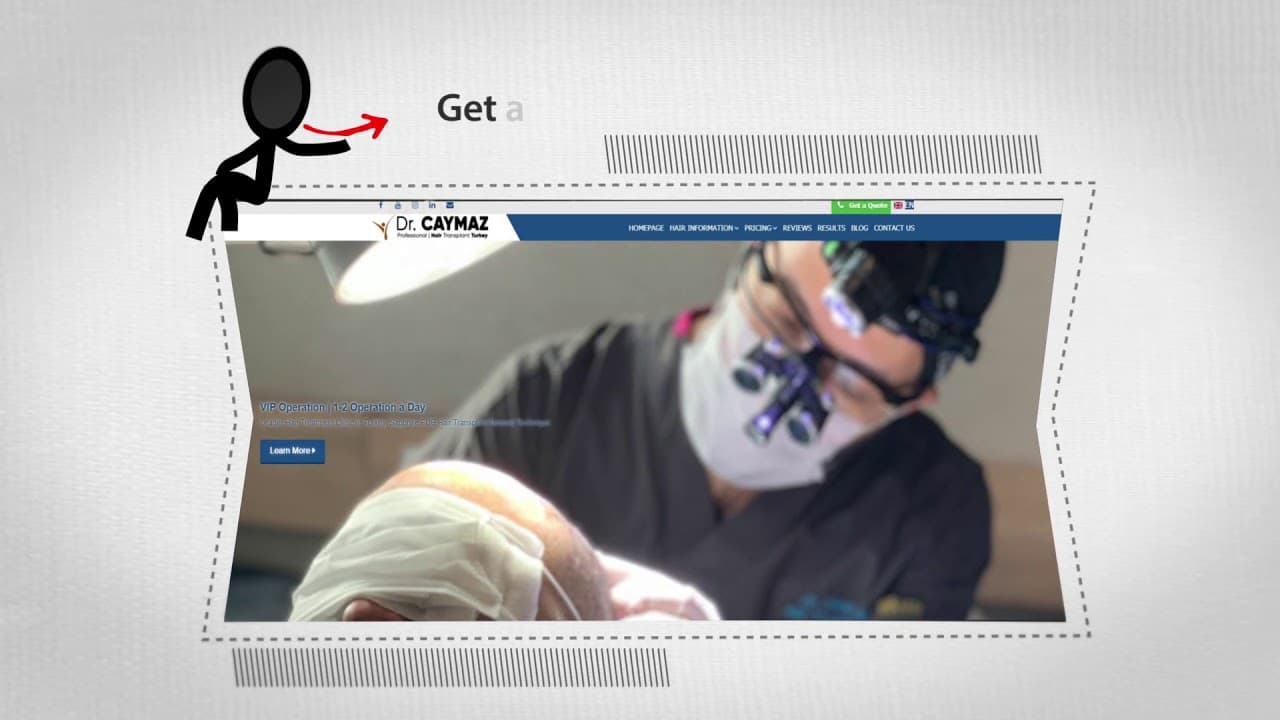 Dr Erkam Caymaz Promotion - Hair Transplant in Istanbul Turkey