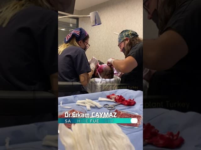 Hair Transplant in Istanbul