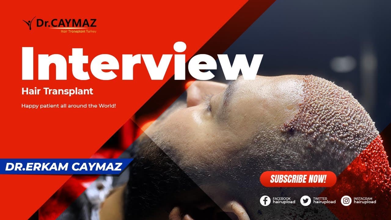 Implanted Hair Permanent? Is Hair Transplantation Painfull?