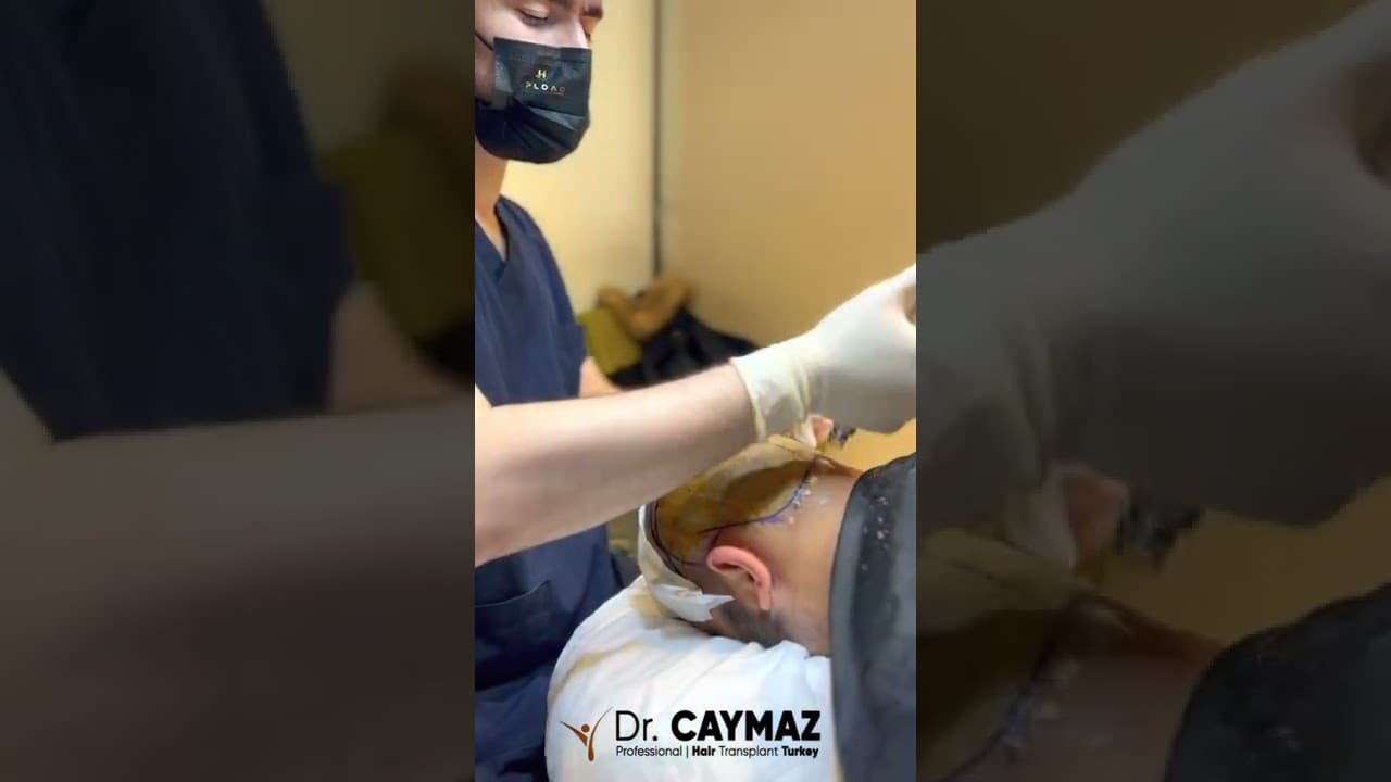 Needleless Anesthesia