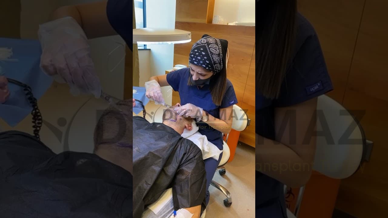 Hair Transplantation in Istanbul