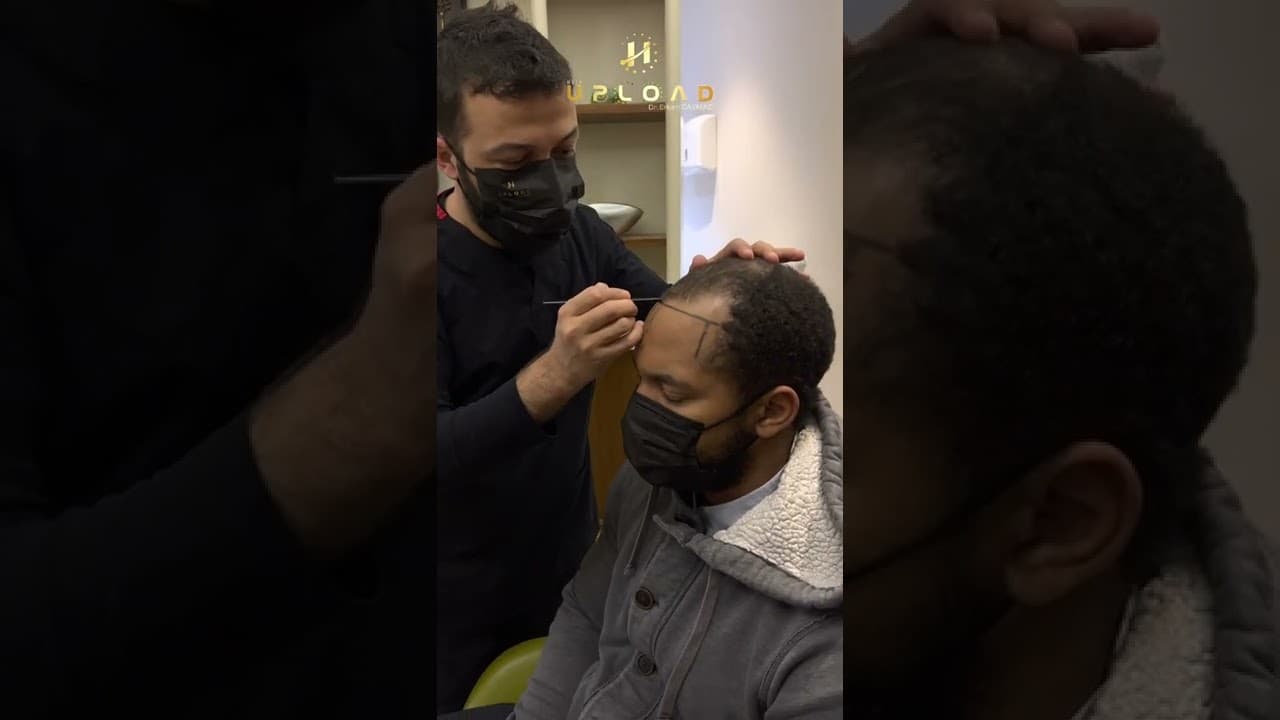 Hairline Preparing Afro-American