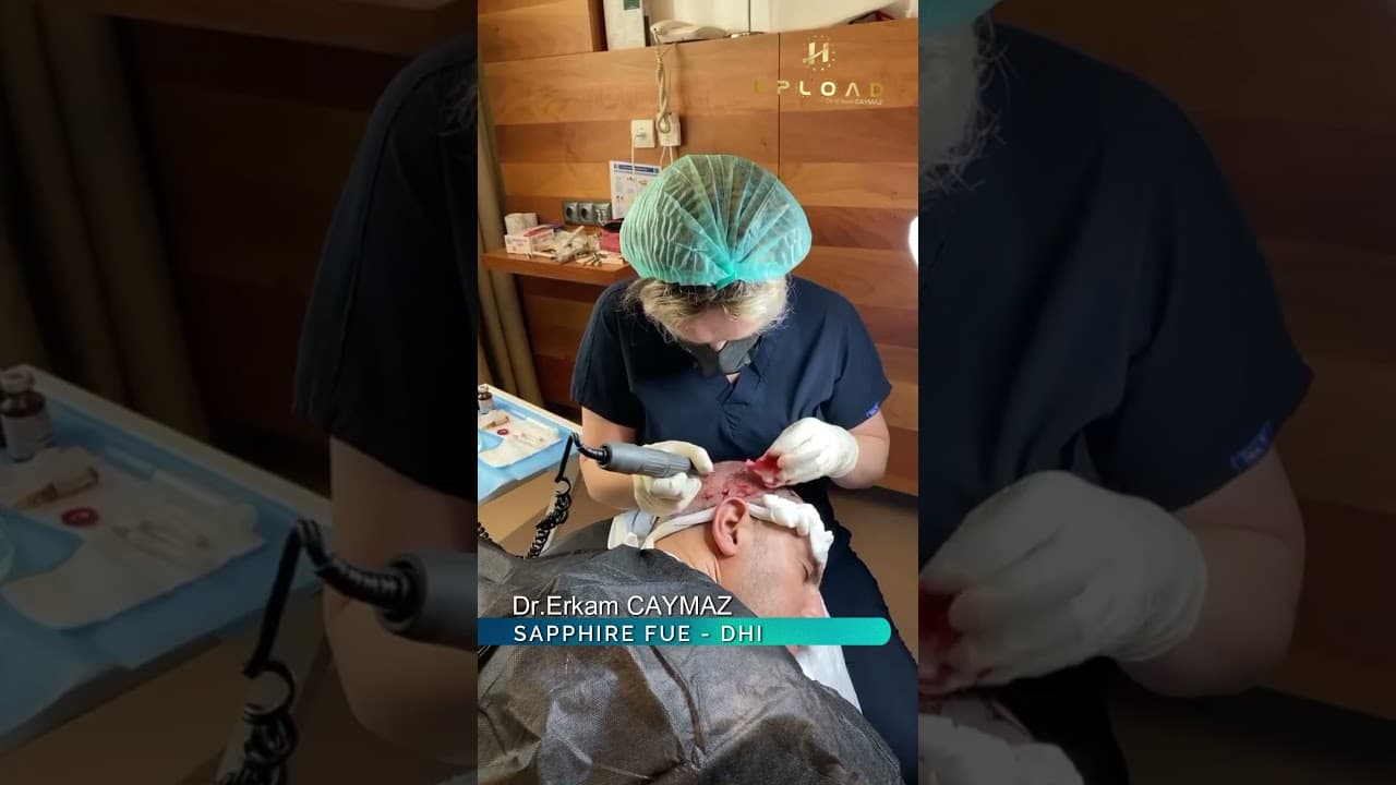 Hair Transplant Operation Day