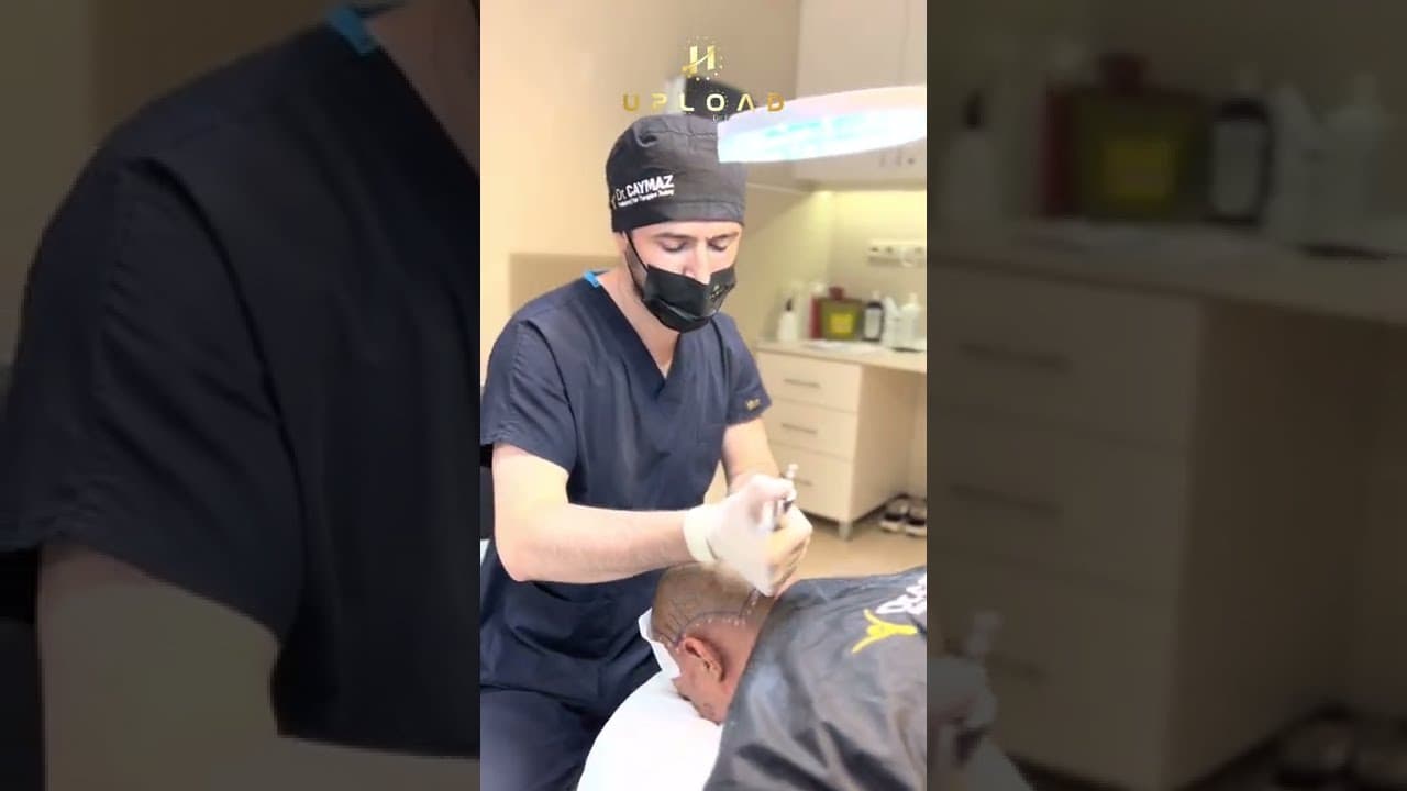 Needleless Anesthesia during Hair Transplantation