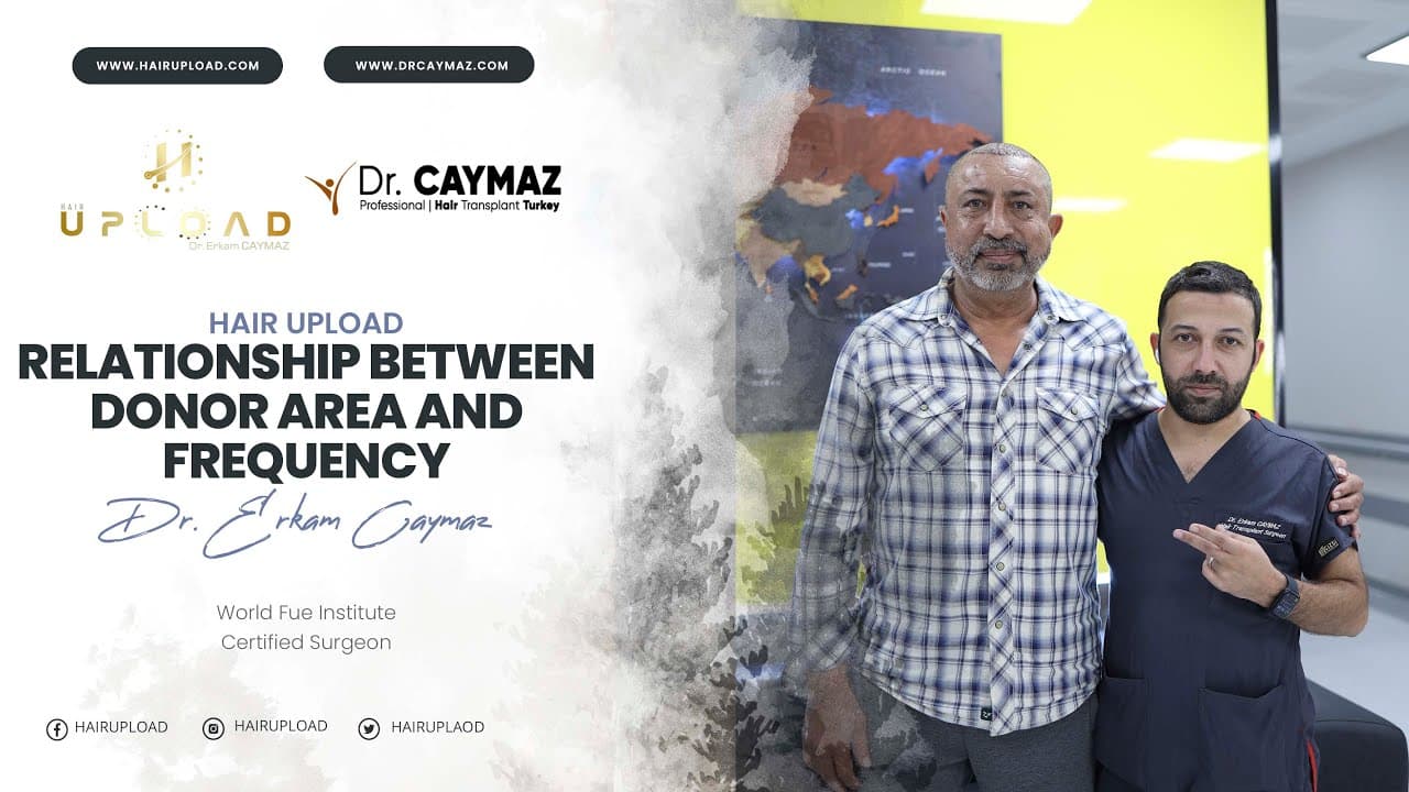 Relationship Between Donor Area And Frequency - Hair Transplant Turkey