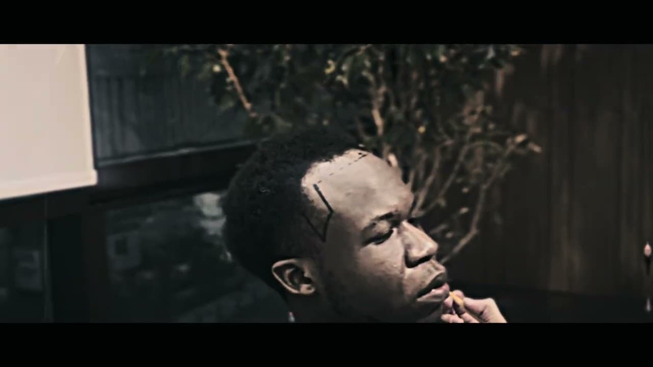 Afro American Hair Transplant