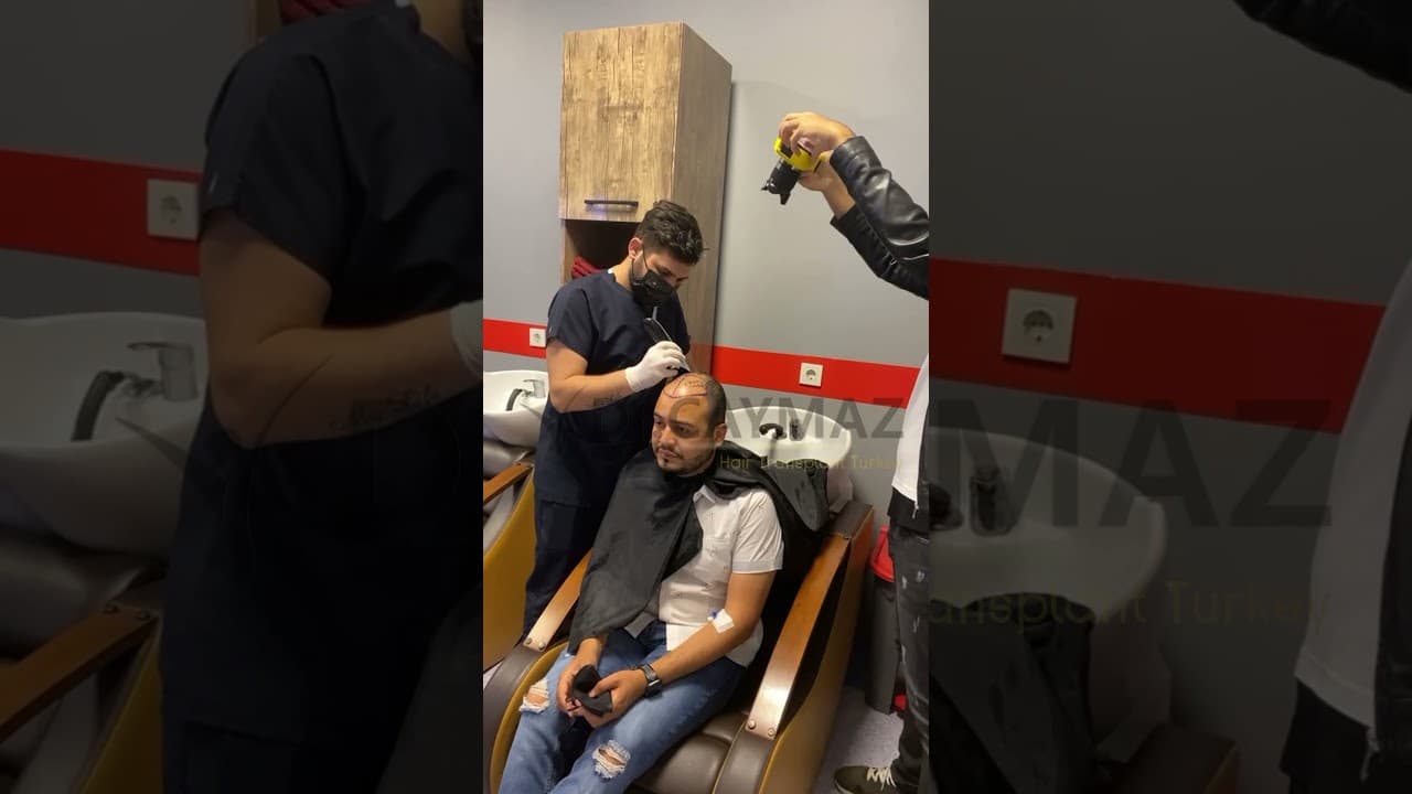 Hairline Design with Laser and Process