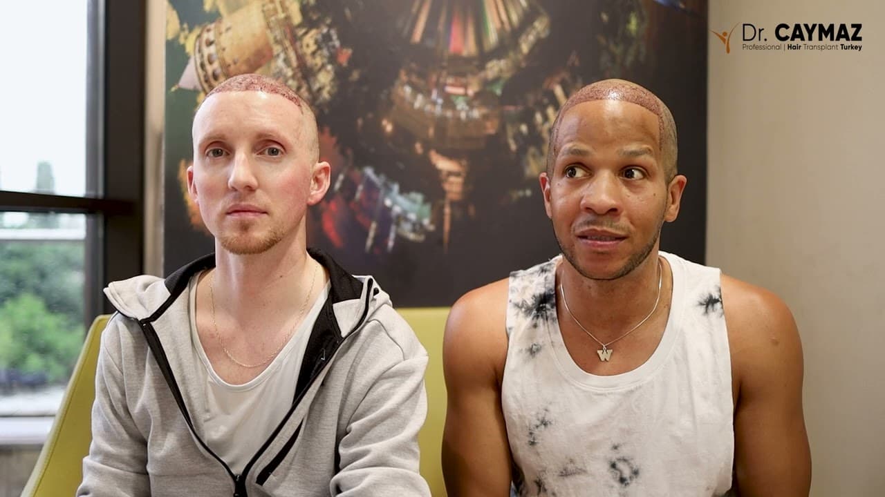 Wilbert Lee &  Kurt Daniel LEE - USA-Afro American Hair Transplant Review - Sapphire Blade Incision