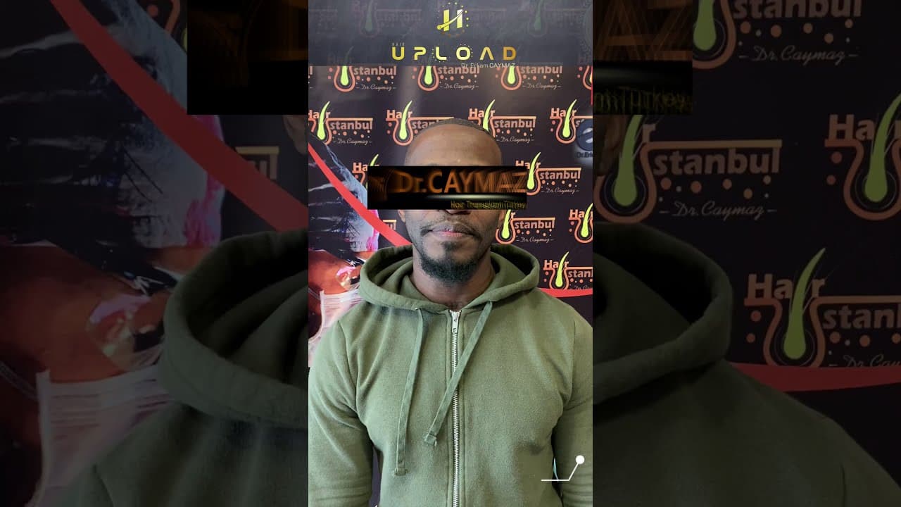 Mr Private - 3000 Graft from USA | Afroamerican Hair Transplant 2021 / Dr.Erkam CAYMAZ