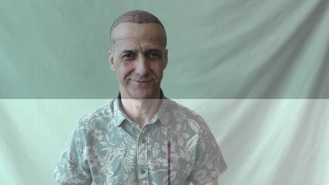 Mr Eduardo - Brasil Reveja - Hair Upload Clinic