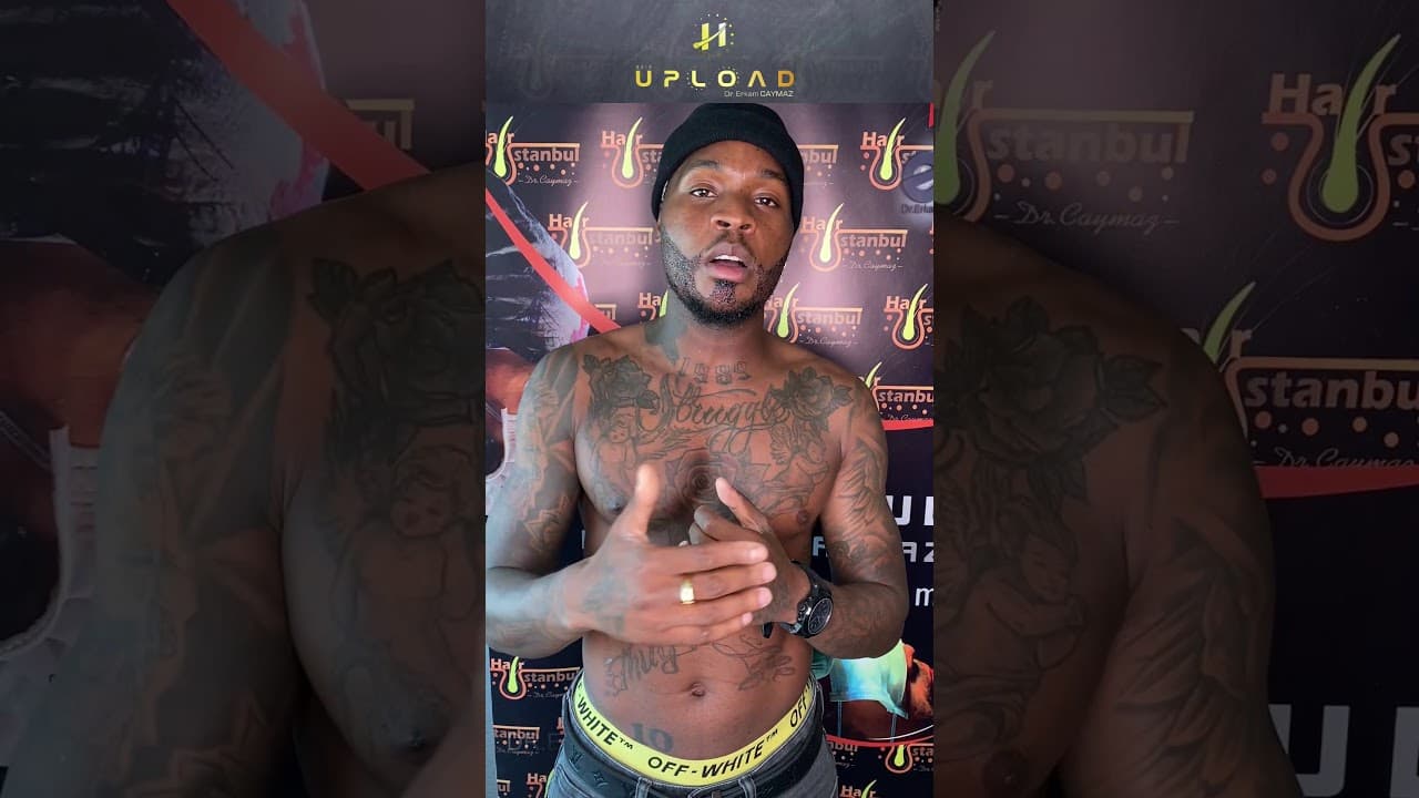 Mr Axel from Belgium - 3500 Graft | Hair Transplant 