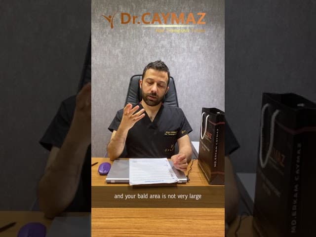 Does hair transplant give permanent results