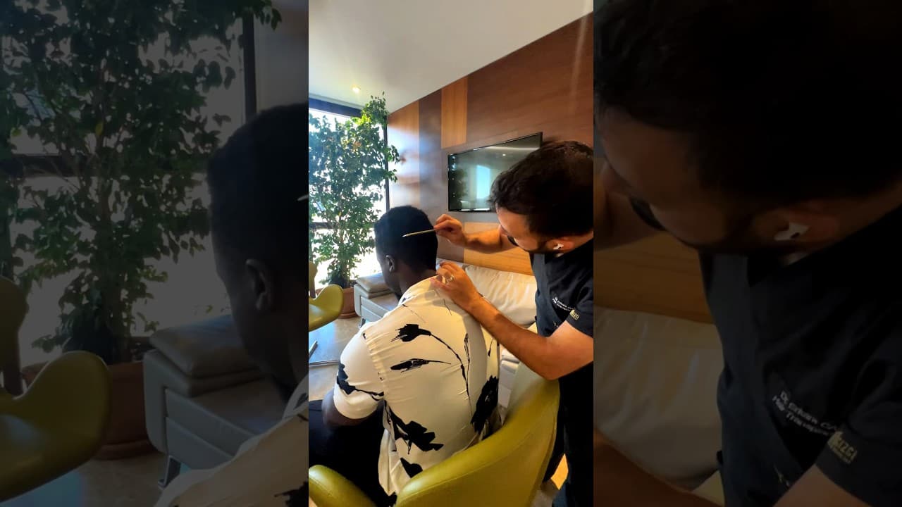 Best Hair Transplantation in Turkiye by Doctor